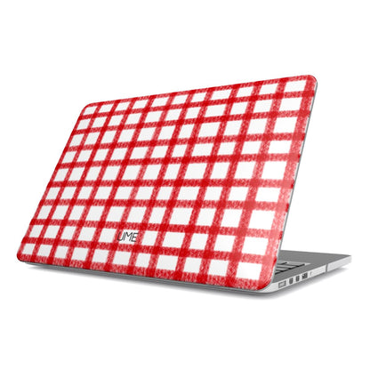 LOVELY - MACBOOK