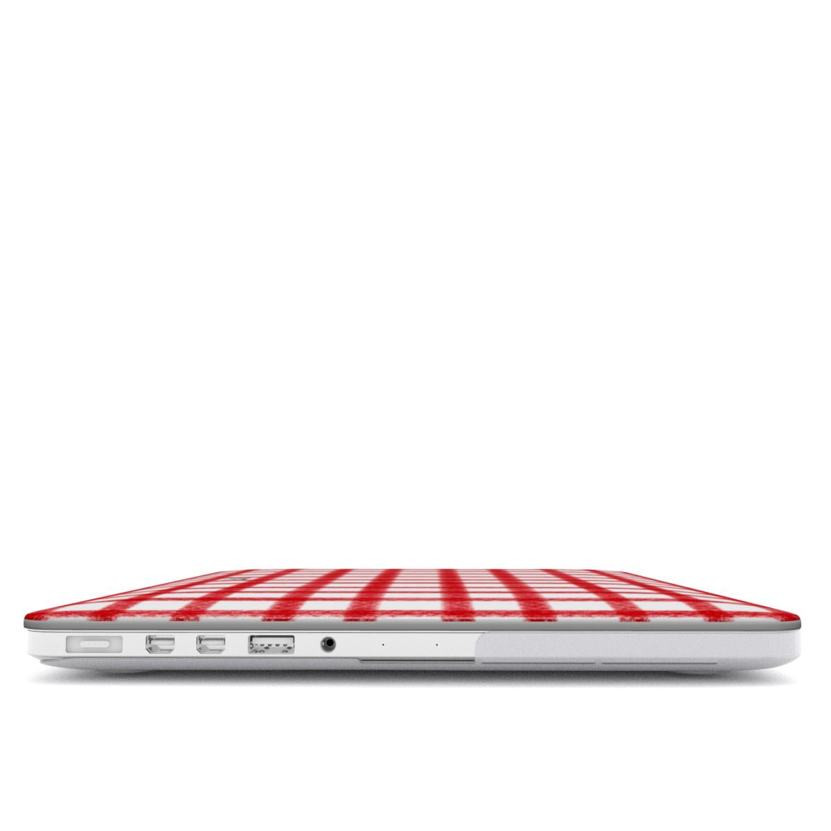 LOVELY - MACBOOK