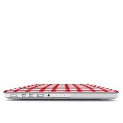 LOVELY - MACBOOK